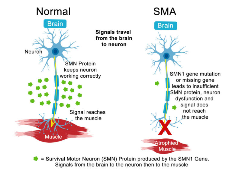 SMA           چیست