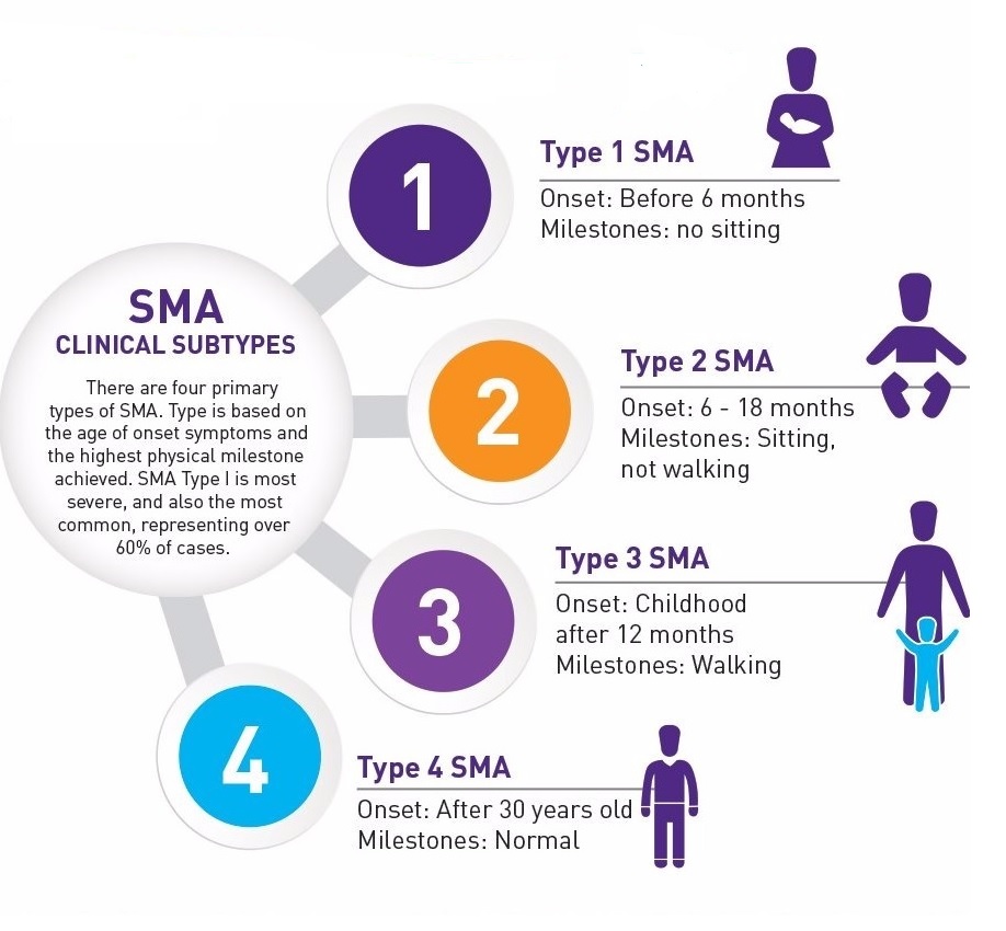 SMA           چیست